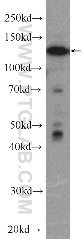 Western Blot (WB) analysis of PC-3 cells using NOL6 Polyclonal antibody (15706-1-AP)
