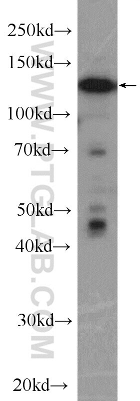 WB analysis of PC-3 using 15706-1-AP