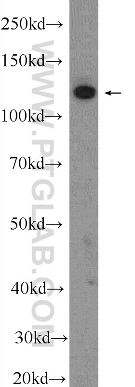 WB analysis of SGC-7901 using 15706-1-AP