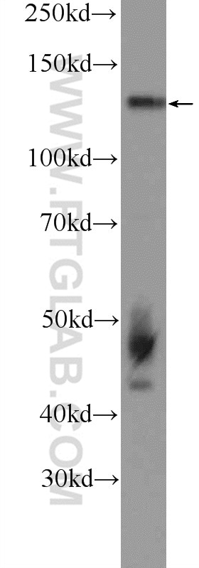 Western Blot (WB) analysis of SGC-7901 cells using NOL6 Polyclonal antibody (15706-1-AP)