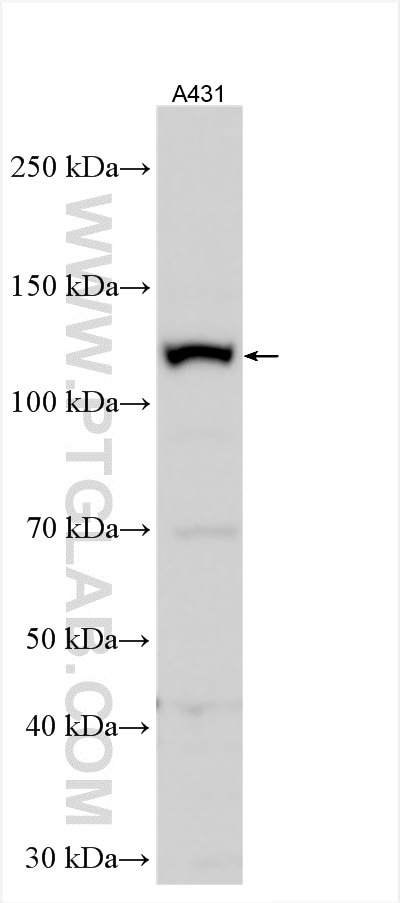 Western Blot (WB) analysis of various lysates using NOL6 Polyclonal antibody (15706-1-AP)