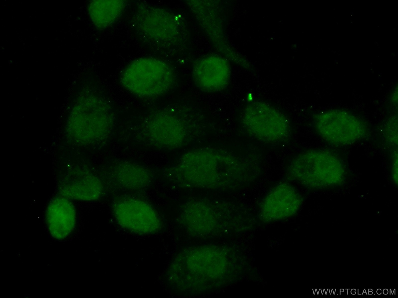 Immunofluorescence (IF) / fluorescent staining of A431 cells using NOL6 Polyclonal antibody (16361-1-AP)