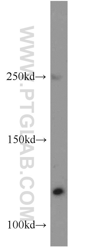 Western Blot (WB) analysis of A431 cells using NOL6 Polyclonal antibody (16361-1-AP)