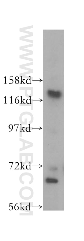 Western Blot (WB) analysis of A431 cells using NOL6 Polyclonal antibody (16361-1-AP)