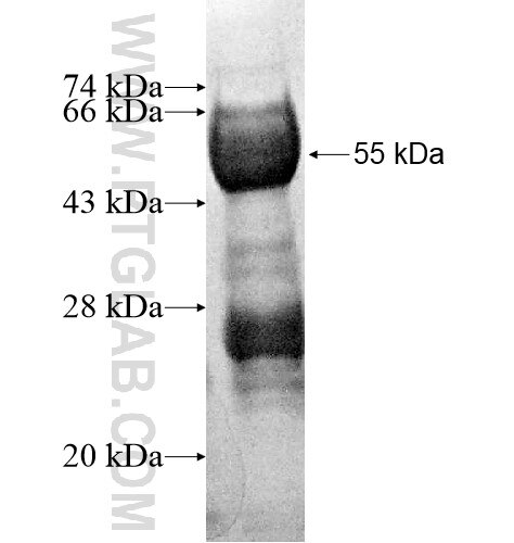 NOL7 fusion protein Ag13272 SDS-PAGE