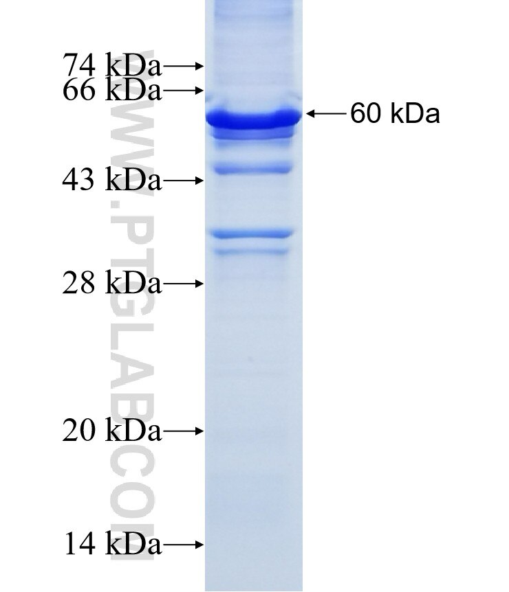 NOL7 fusion protein Ag13272 SDS-PAGE