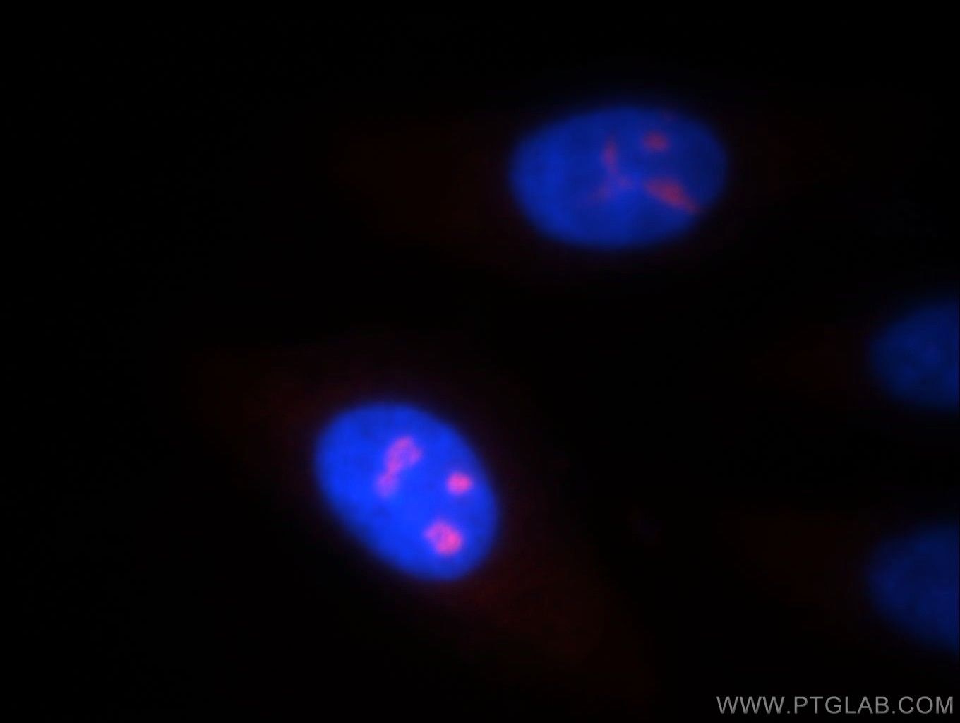 Immunofluorescence (IF) / fluorescent staining of HepG2 cells using NOL8 Polyclonal antibody (12043-1-AP)