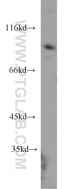 WB analysis of HepG2 using 16083-1-AP