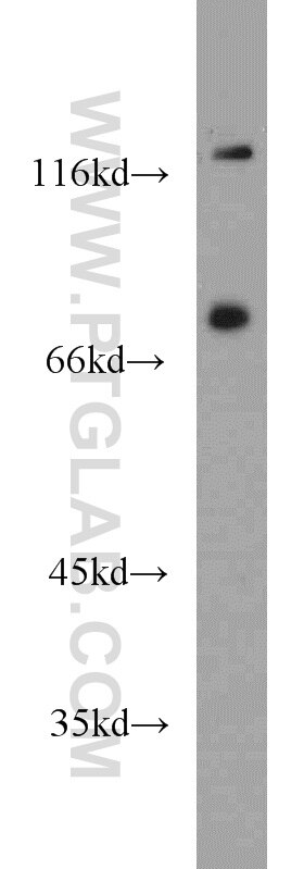 Western Blot (WB) analysis of PC-3 cells using NOL9 Polyclonal antibody (16083-1-AP)