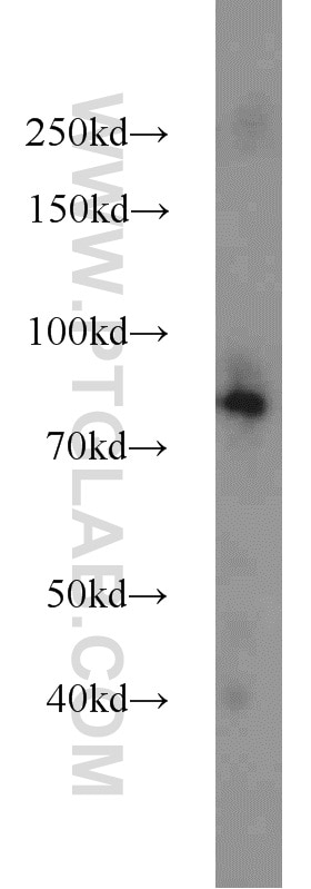 Western Blot (WB) analysis of HEK-293 cells using NOL9 Polyclonal antibody (16083-1-AP)