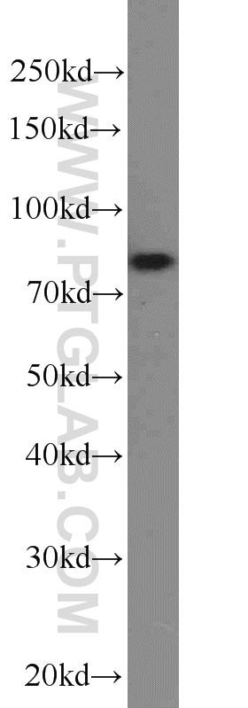 Western Blot (WB) analysis of HEK-293 cells using NOL9 Polyclonal antibody (16083-1-AP)