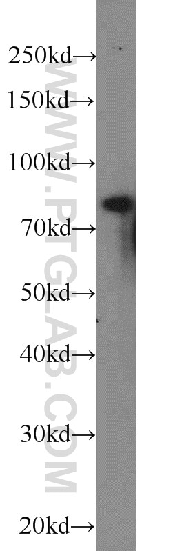 Western Blot (WB) analysis of HEK-293 cells using NOL9 Polyclonal antibody (16083-1-AP)