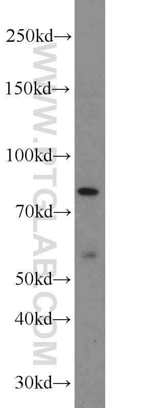 Western Blot (WB) analysis of PC-3 cells using NOL9 Polyclonal antibody (16083-1-AP)