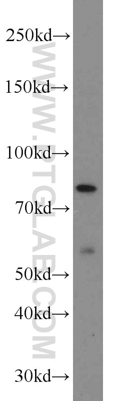 WB analysis of PC-3 using 16083-1-AP