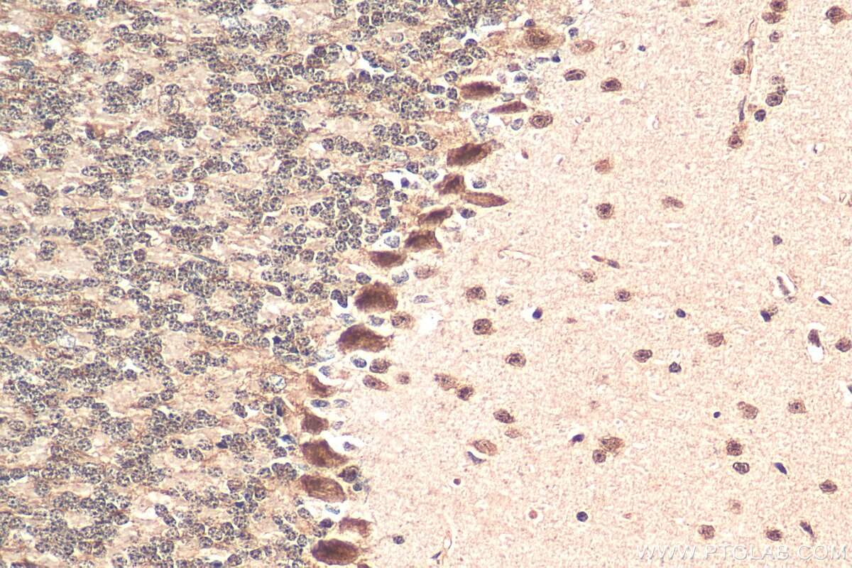 Immunohistochemistry (IHC) staining of mouse cerebellum tissue using NOM1 Polyclonal antibody (29798-1-AP)