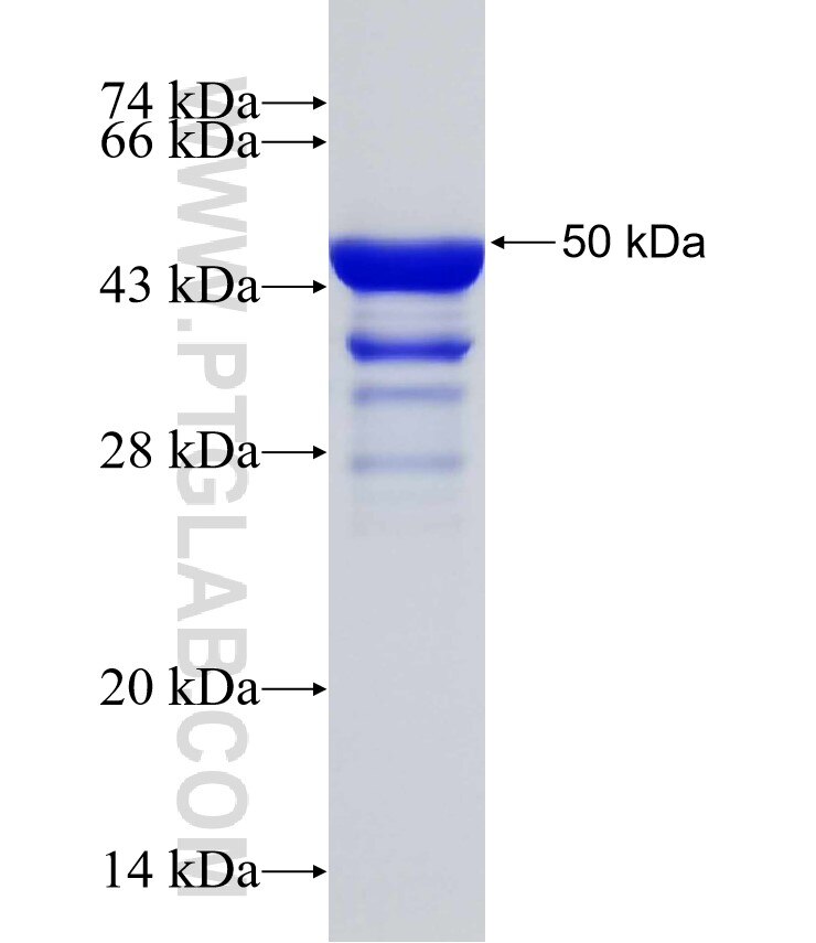 NOM1 fusion protein Ag31423 SDS-PAGE