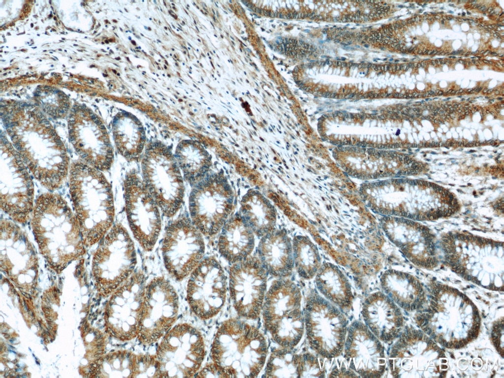 Immunohistochemistry (IHC) staining of human colon tissue using NOMO1 Polyclonal antibody (17792-1-AP)