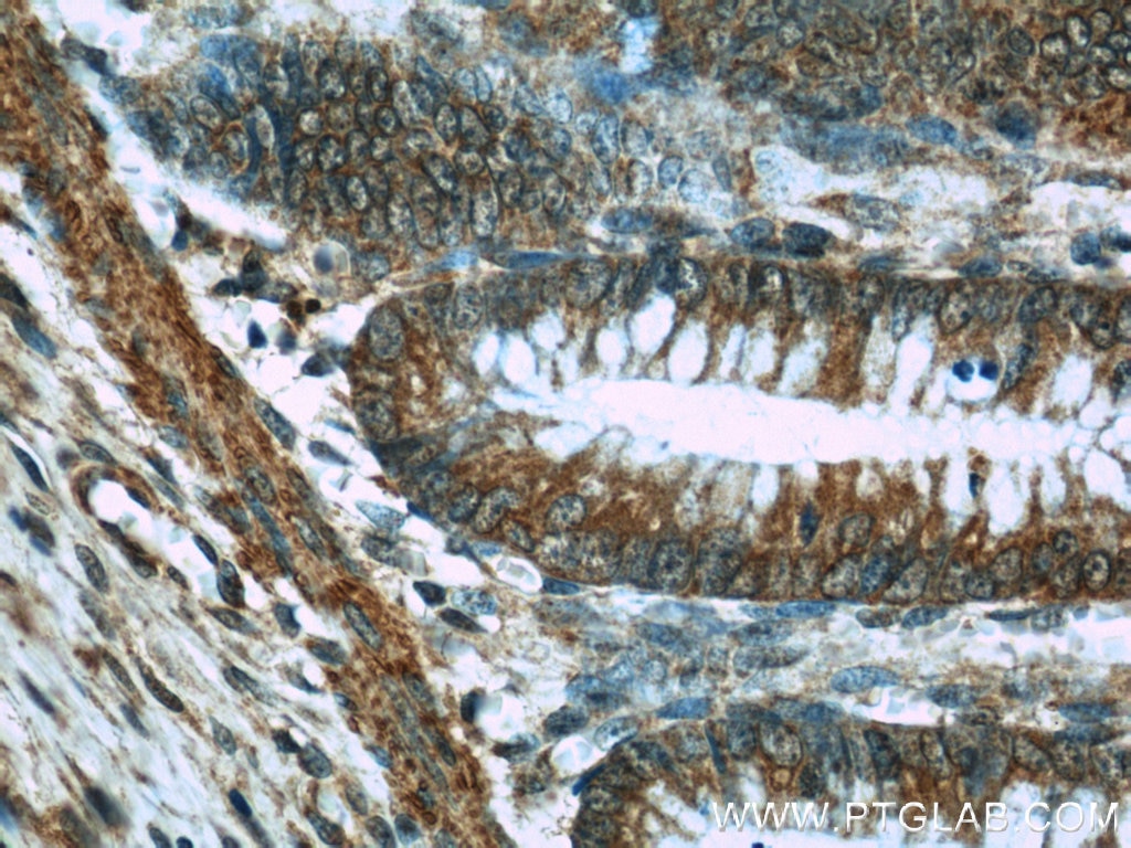 Immunohistochemistry (IHC) staining of human colon tissue using NOMO1 Polyclonal antibody (17792-1-AP)