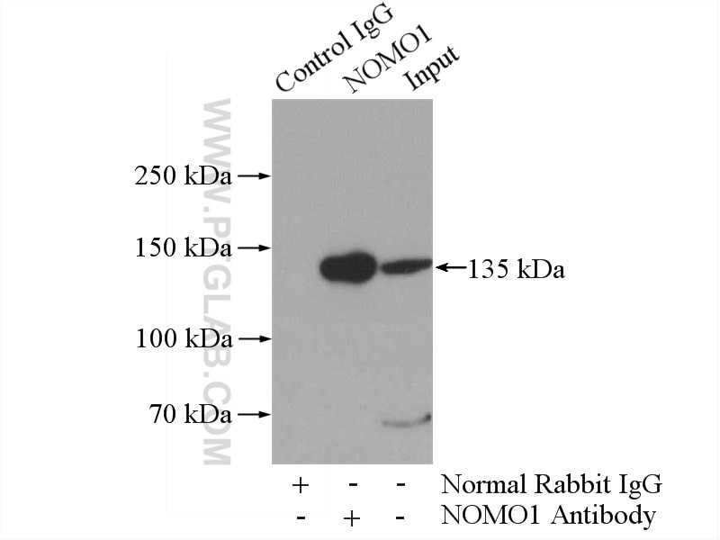 Immunoprecipitation (IP) experiment of A431 cells using NOMO1 Polyclonal antibody (17792-1-AP)