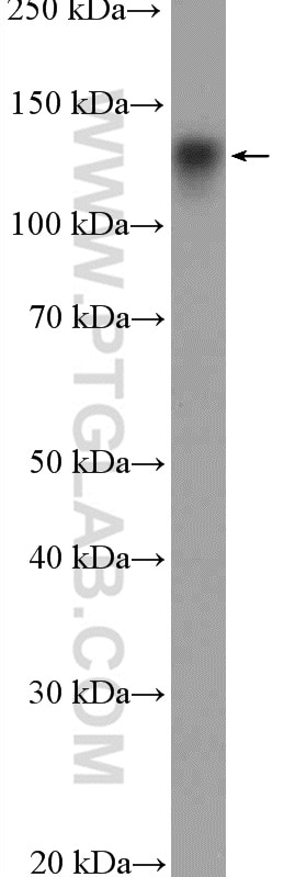 Western Blot (WB) analysis of COLO 320 cells using NOMO1 Polyclonal antibody (17792-1-AP)