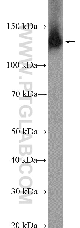 Western Blot (WB) analysis of A431 cells using NOMO1 Polyclonal antibody (17792-1-AP)