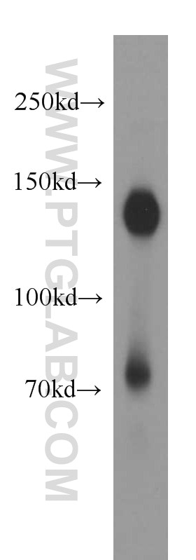 Western Blot (WB) analysis of human brain tissue using NOMO1 Polyclonal antibody (17792-1-AP)