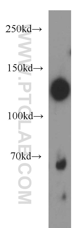 Western Blot (WB) analysis of A431 cells using NOMO1 Polyclonal antibody (17792-1-AP)