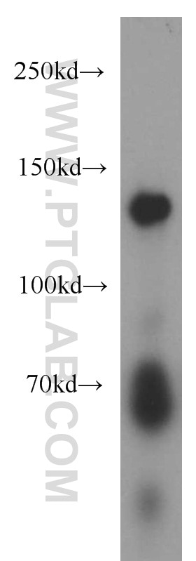 Western Blot (WB) analysis of mouse colon tissue using NOMO1 Polyclonal antibody (17792-1-AP)