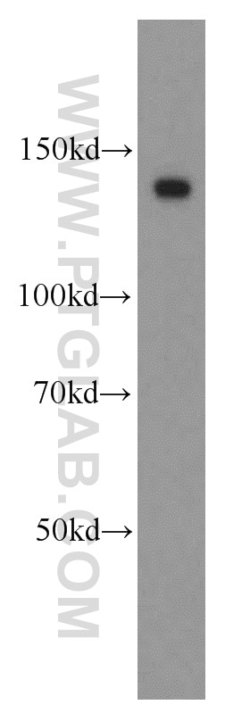 Western Blot (WB) analysis of COLO 320 cells using NOMO1 Polyclonal antibody (17792-1-AP)