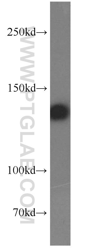 Western Blot (WB) analysis of A431 cells using NOMO1 Polyclonal antibody (17792-1-AP)