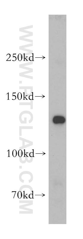 Western Blot (WB) analysis of mouse colon tissue using NOMO1 Polyclonal antibody (17792-1-AP)