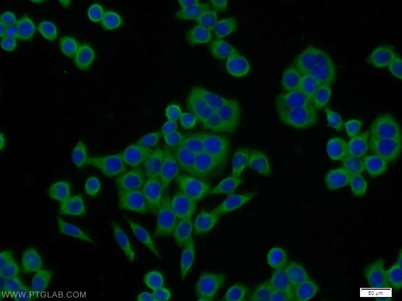 IF Staining of BxPC-3 using 14328-1-AP