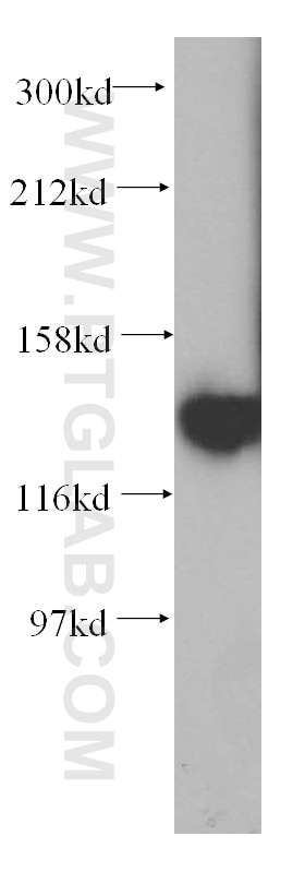 WB analysis of HEK-293 using 14328-1-AP