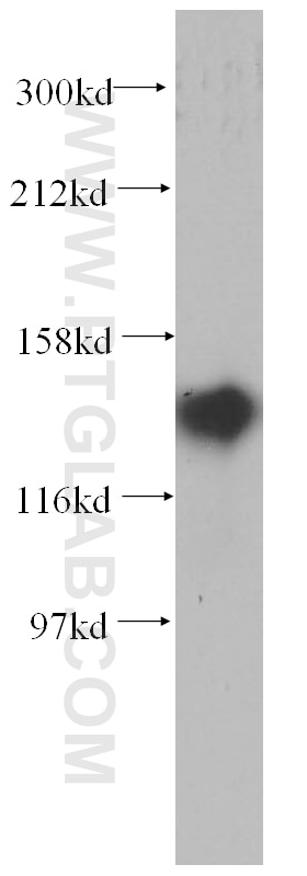 Western Blot (WB) analysis of BxPC-3 cells using NOMO2 Polyclonal antibody (14328-1-AP)