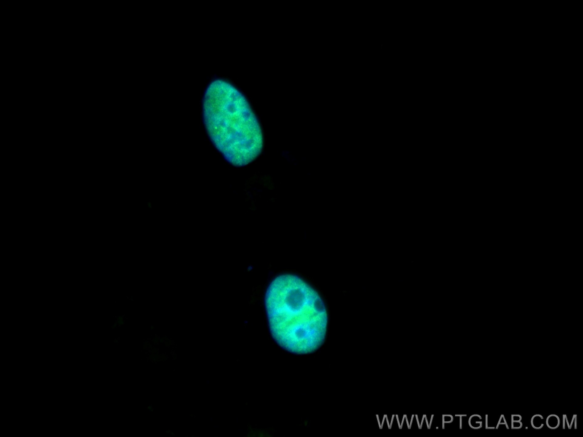 Immunofluorescence (IF) / fluorescent staining of HEK-293 cells using NONO Polyclonal antibody (11058-1-AP)