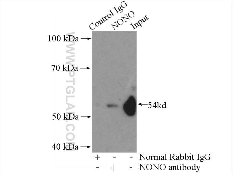 Immunoprecipitation (IP) experiment of HEK-293 cells using NONO Polyclonal antibody (11058-1-AP)