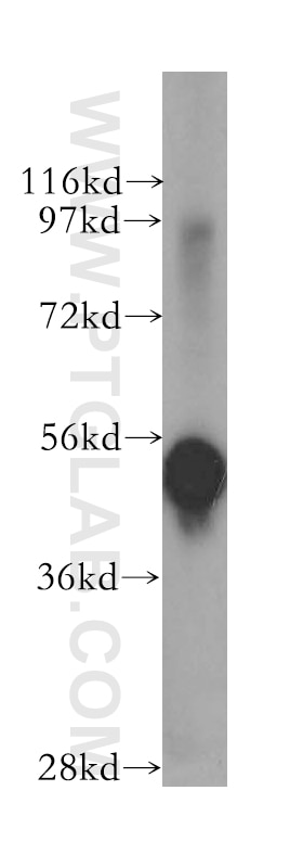 Western Blot (WB) analysis of human pancreas tissue using NONO Polyclonal antibody (11058-1-AP)