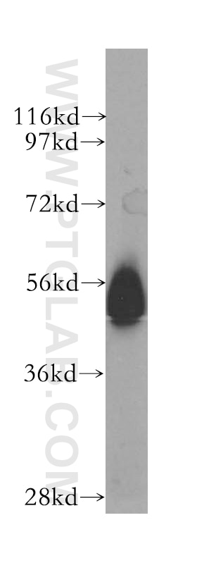 Western Blot (WB) analysis of human skeletal muscle tissue using NONO Polyclonal antibody (11058-1-AP)