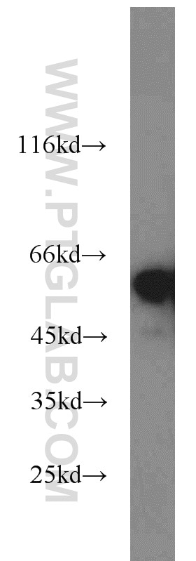Western Blot (WB) analysis of HEK-293 cells using NONO Polyclonal antibody (11058-1-AP)