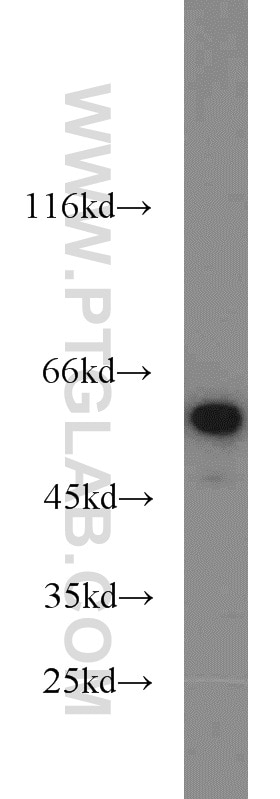 Western Blot (WB) analysis of MCF-7 cells using NONO Polyclonal antibody (11058-1-AP)