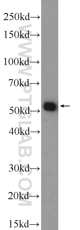Western Blot (WB) analysis of HEK-293 cells using NONO Polyclonal antibody (11058-1-AP)