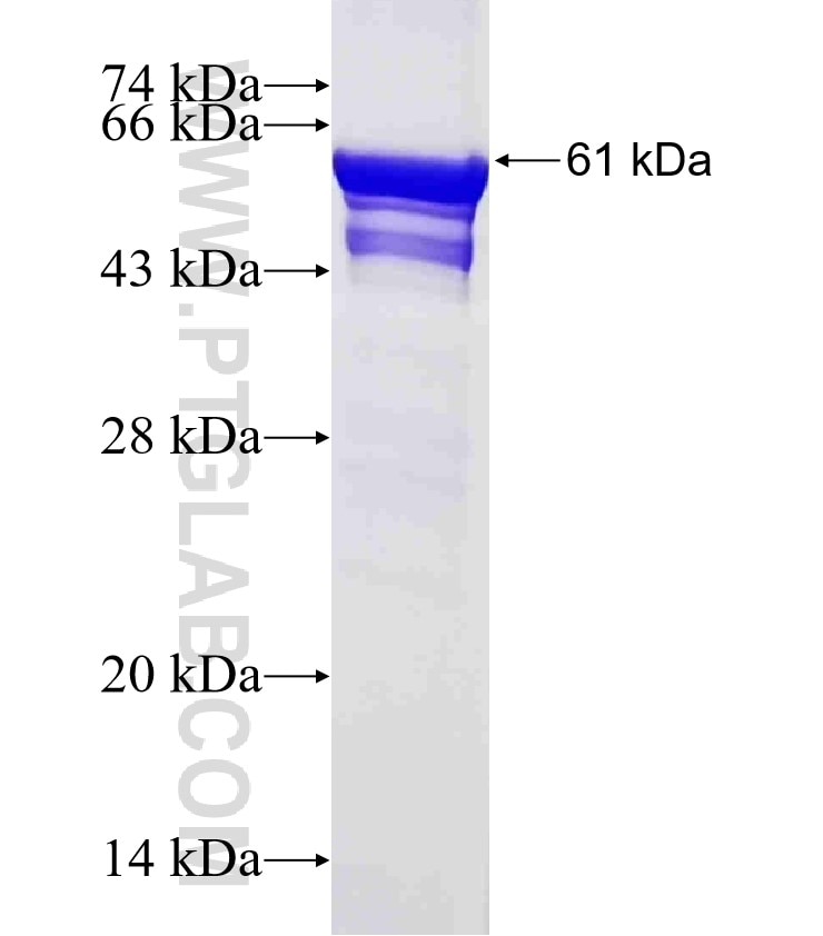 NONO fusion protein Ag1512 SDS-PAGE