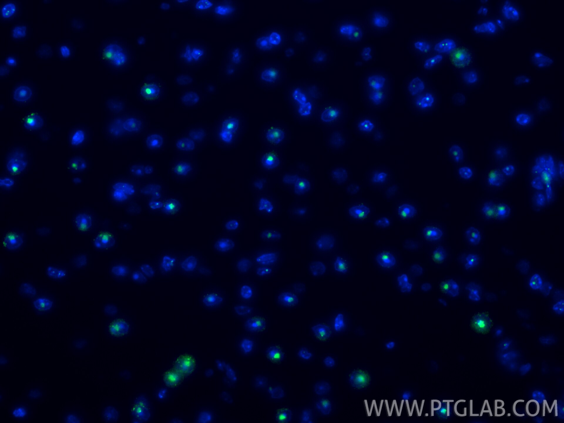 IF Staining of mouse brain using 87529-1-RR Immunofluorescence (IF) / fluorescent staining of mouse brain tissue using NOP10 Recombinant monoclonal antibody (87529-1-RR)