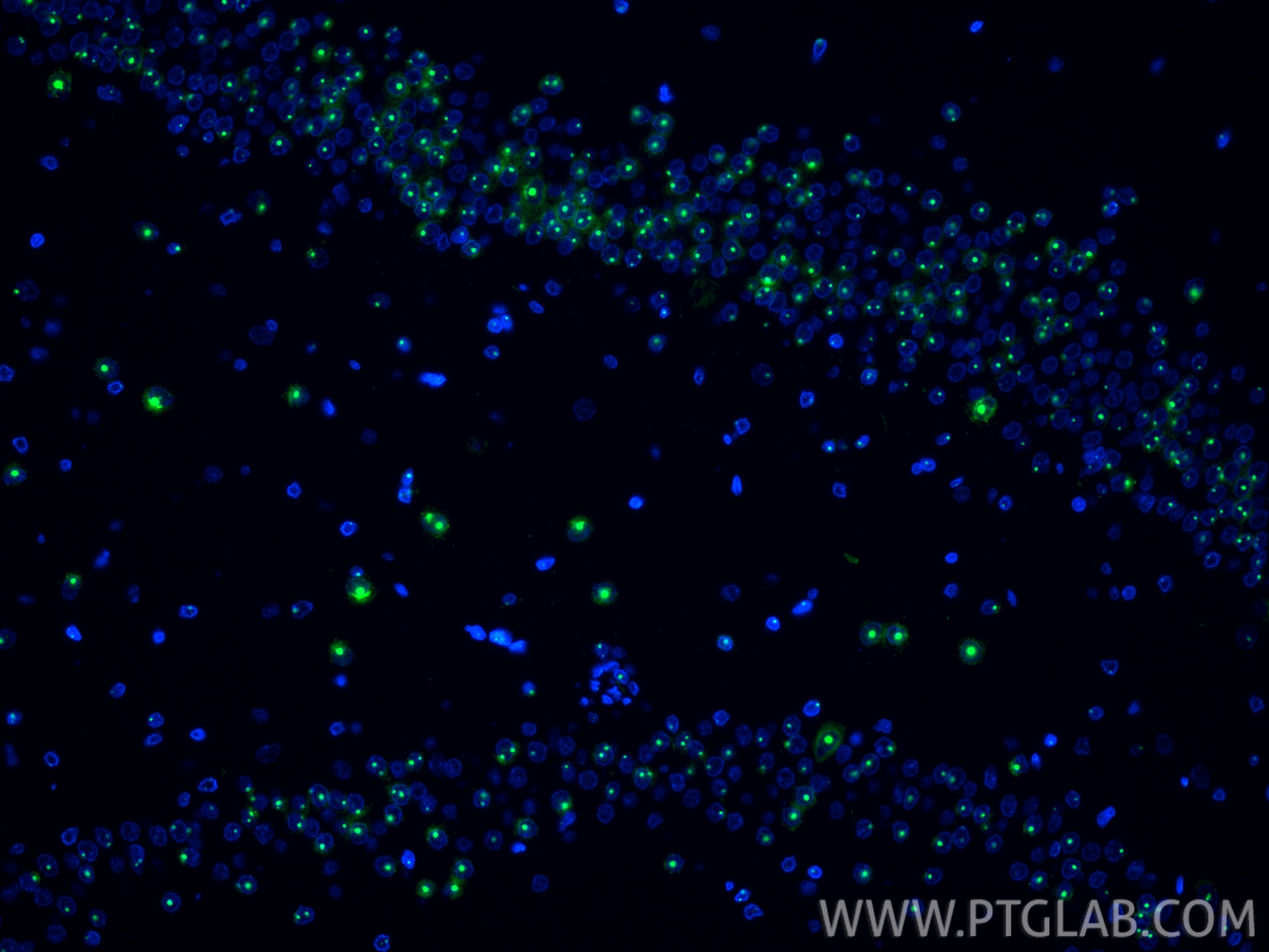 IF Staining of rat brain using 87529-1-RR Immunofluorescence (IF) / fluorescent staining of rat brain tissue using NOP10 Recombinant monoclonal antibody (87529-1-RR)