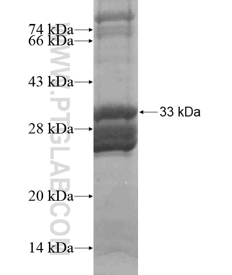 NOP10 fusion protein Ag18718 SDS-PAGE