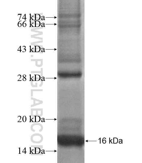 NOP10 fusion protein Ag18978 SDS-PAGE