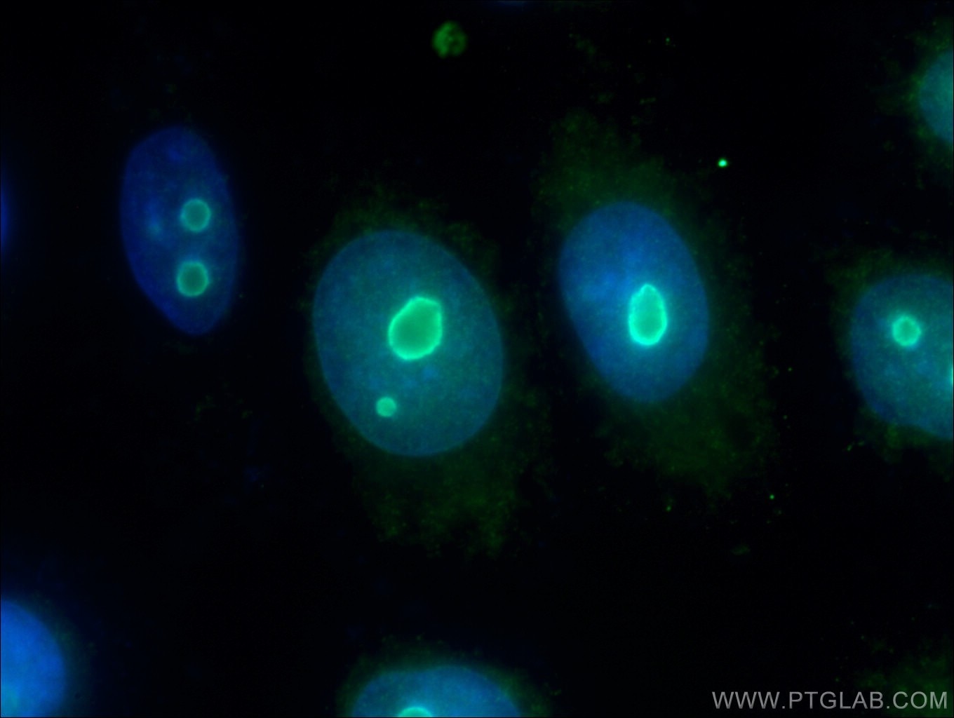 Immunofluorescence (IF) / fluorescent staining of HepG2 cells using NOP14 Polyclonal antibody (26854-1-AP)