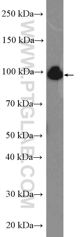 Western Blot (WB) analysis of BxPC-3 cells using NOP14 Polyclonal antibody (26854-1-AP)