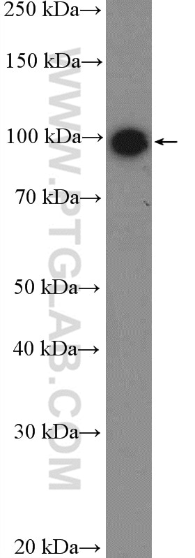 Western Blot (WB) analysis of MDA-MB-453s cells using NOP14 Polyclonal antibody (26854-1-AP)