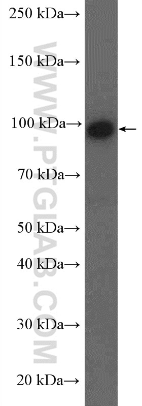 Western Blot (WB) analysis of BxPC-3 cells using NOP14 Polyclonal antibody (26854-1-AP)